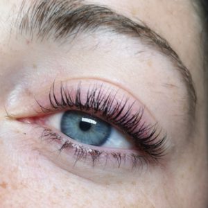 eye after eyelash extension treatment