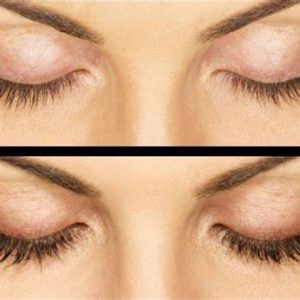 eyes looking down showing before and after eyelash extension treatment