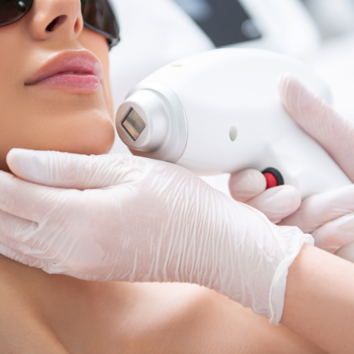 woman having hair removal laser treatment on her chin