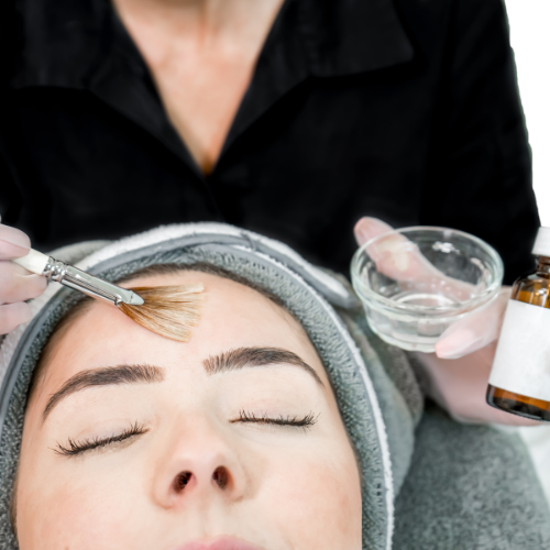 woman having chemical peel treatment forehead is brushed with chemical peel solution