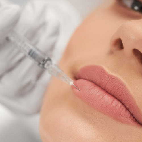 woman having a lip filler injection