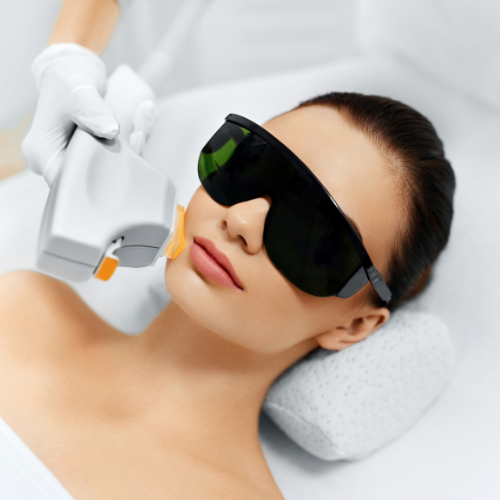 woman wearing eyeglasses and having laser hair removal treatment on her chin