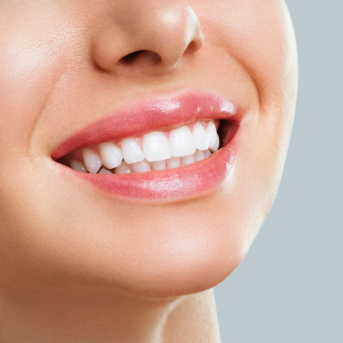 woman smiling with healthy white teeth