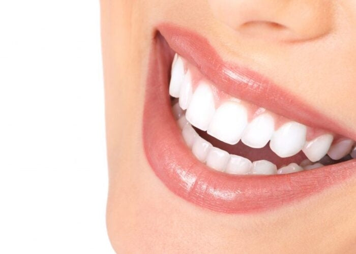 Teeth Whitening Touch up