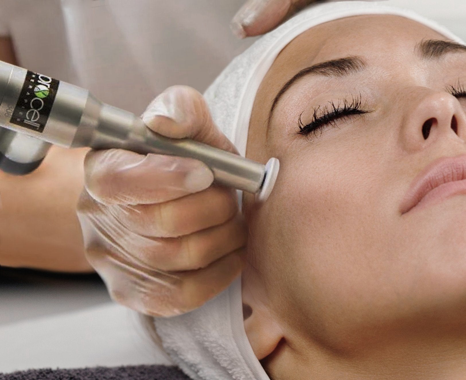 Procell Microchanneling Treatment for Skin Rejuvenation in Canmore